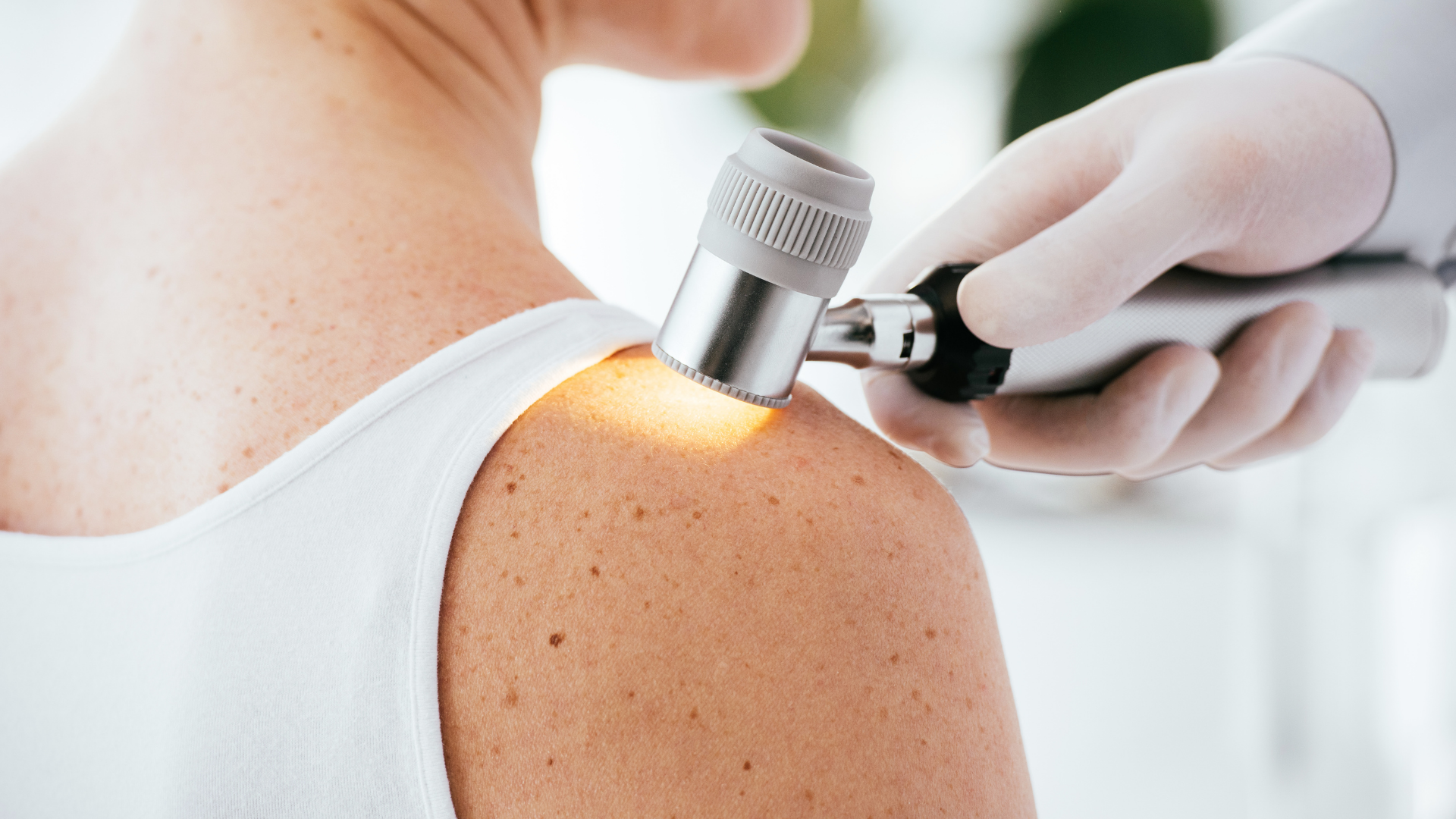 Going beyond the surface – Advancing Care in Atopic Dermatitis and Skin Health